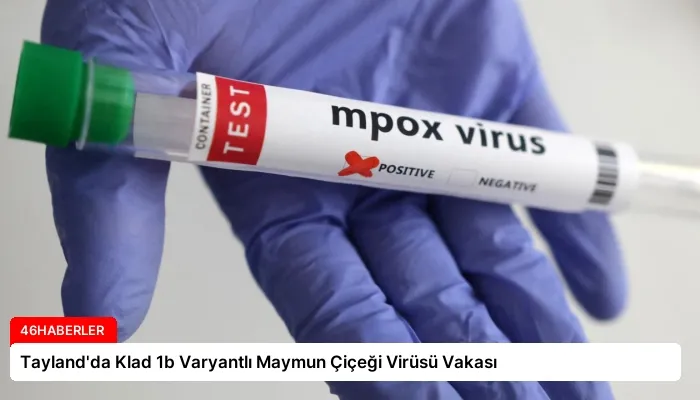 Tayland’da Klad 1b Varyantlı Maymun Çiçeği Virüsü Vakası