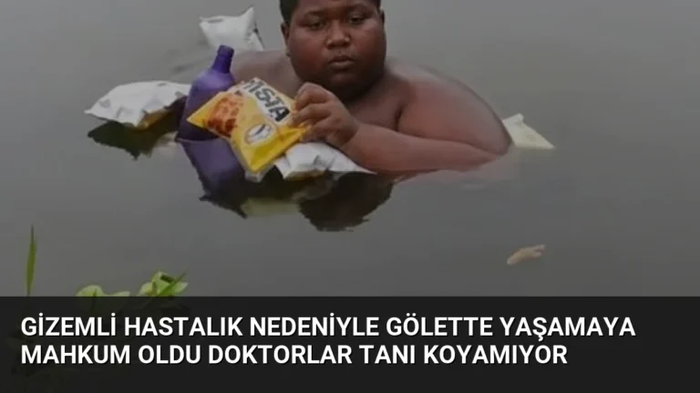 Gizemli Hastalık Nedeniyle Gölette Yaşamaya Mahkum Oldu Doktorlar Tanı Koyamıyor
