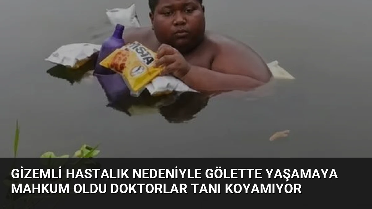 Gizemli Hastalık Nedeniyle Gölette Yaşamaya Mahkum Oldu Doktorlar Tanı Koyamıyor